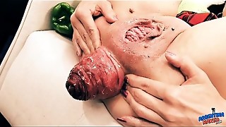 Insanely Huge Prolapse! Cervix Exposure. Eggplant Penetratio